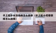 手上起小水泡很痒怎么回事（手上起小疙瘩很痒怎么回事）